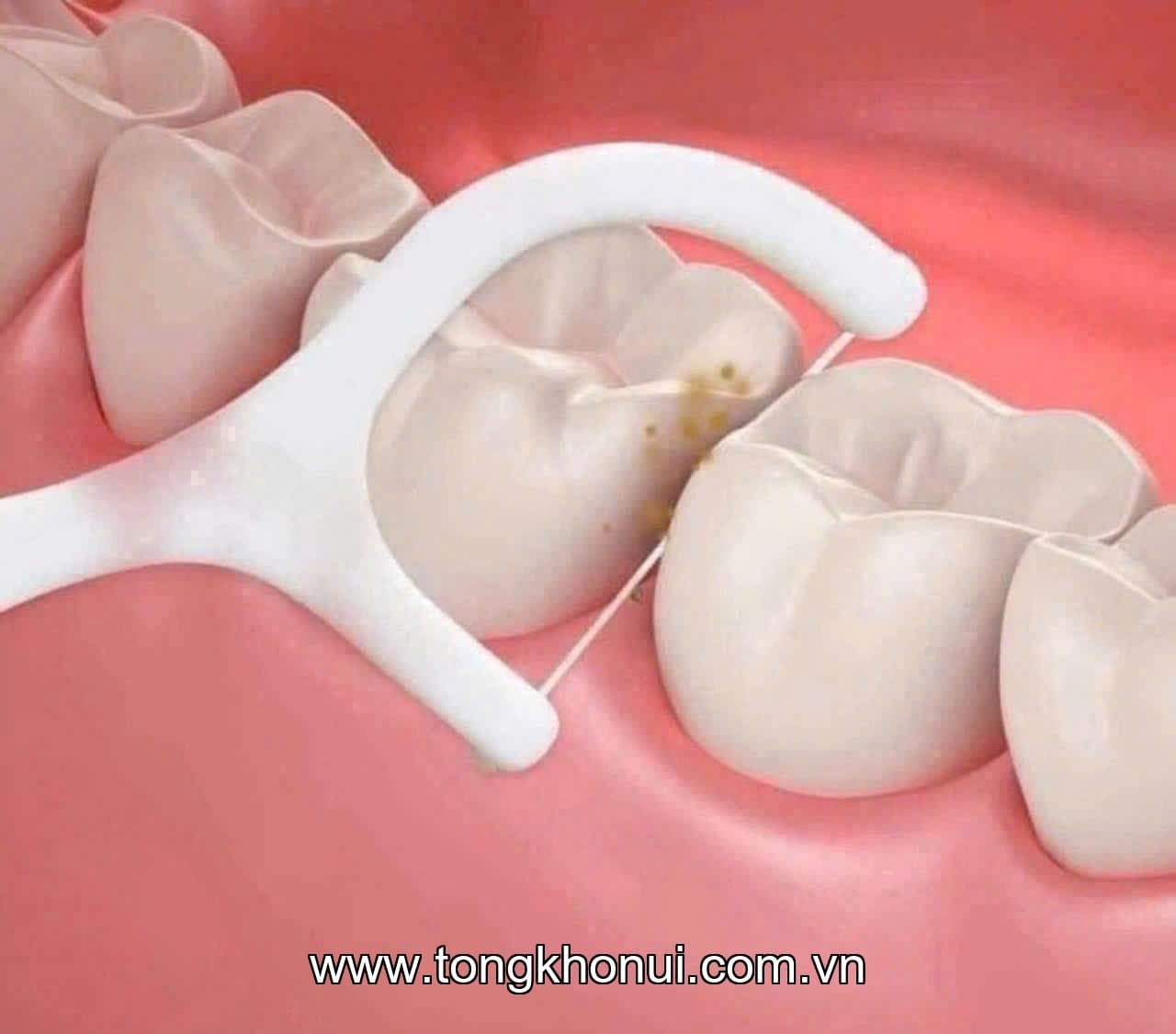 Tăm Chỉ Nha Khoa MYLAN Hộp Tự Động: Tiện Lợi, Tái Sử Dụng – Vệ Sinh Răng Miệng Chuẩn Mới!